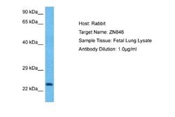 ZNF846 Rabbit anti-Human, Polyclonal, Novus Biologicals 0.1 mL | Buy Online | Novus Biologicals | Fisher Scientific